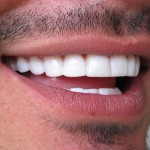 Los dientes, el pelo, el peso, los musculos y tu voz